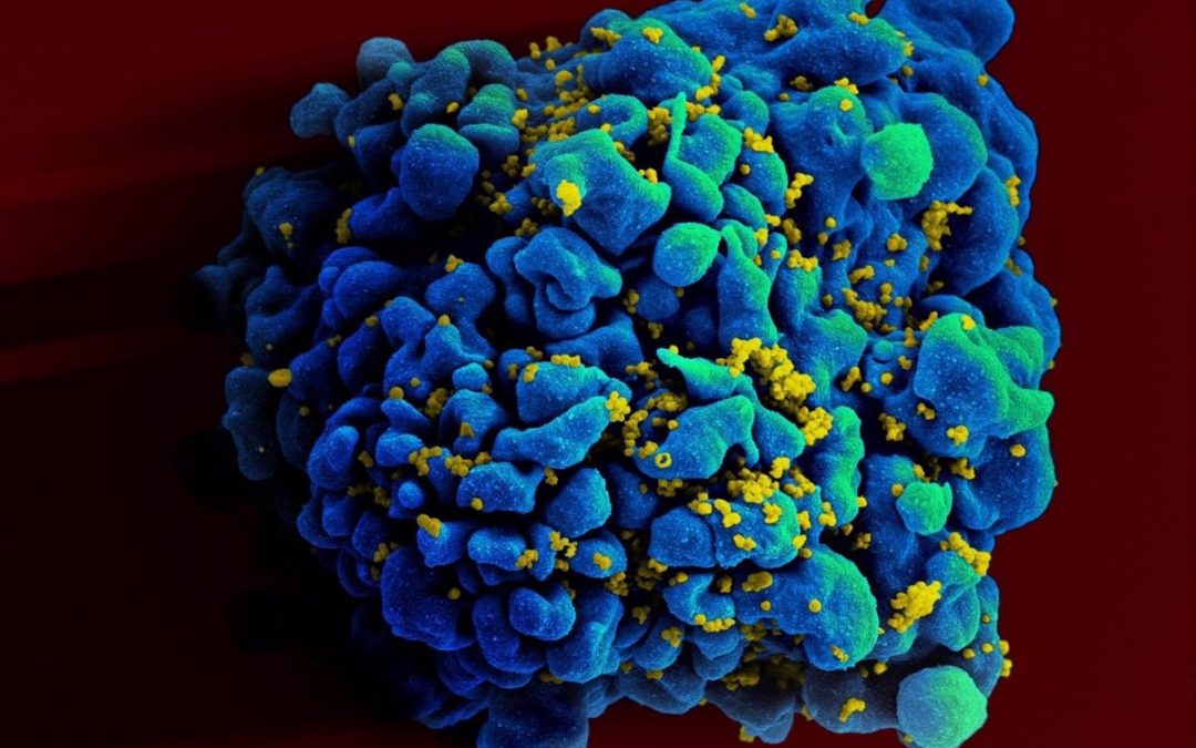 Se identifica una sustancia que podría inhibir la actividad de los reservorios del VIH